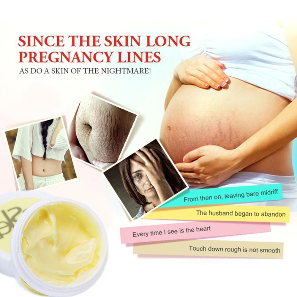 STRETCH MARK & ANTI-AGING CREAM