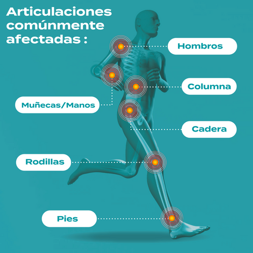 articulaciones afectadas