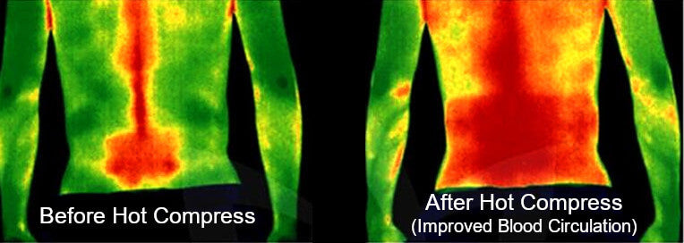 Thermal image of a person before and after hot compress therapy, showing improved blood circulation.