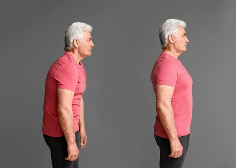 Image of a man before and after posture correction.