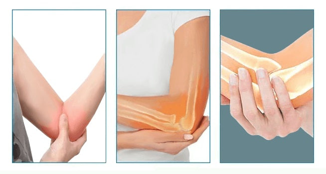 Image showing common elbow conditions that can be addressed by the rehabilitative arm brace.