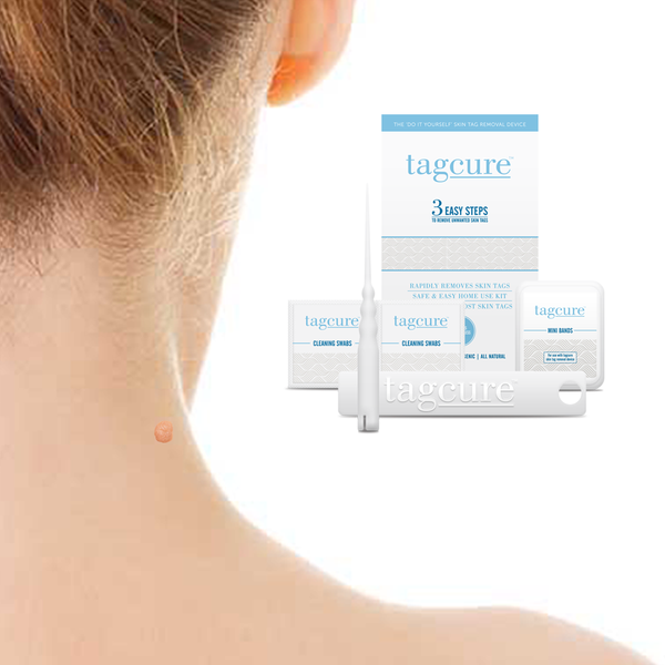 Tagcure - Skin Tag Removal Device - White Packaging 2