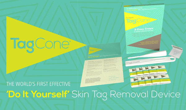 TagCone Original Skin Tag Removal Device 0