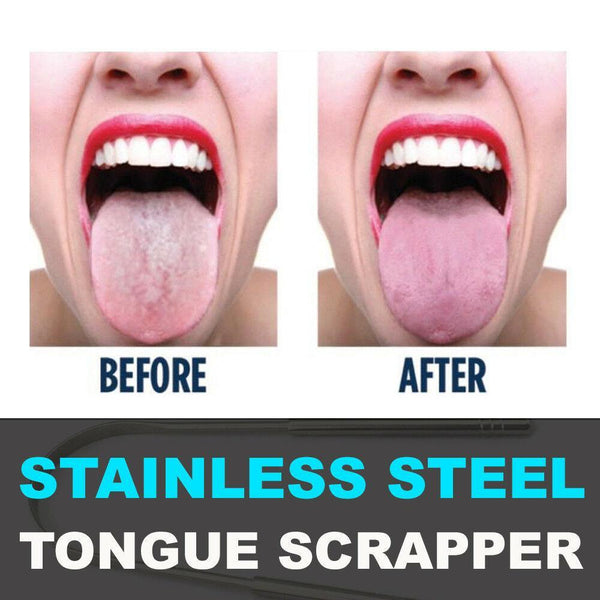Glamza Stainless Steel Tongue Scraper 1