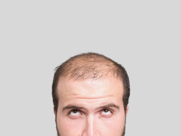 What is a hair patch and how long can it last?