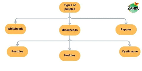 Types of Pimple