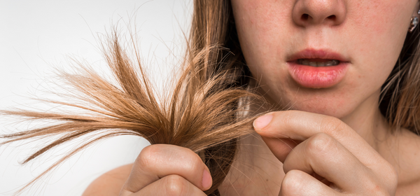 Dry Brittle Hair due to hard water