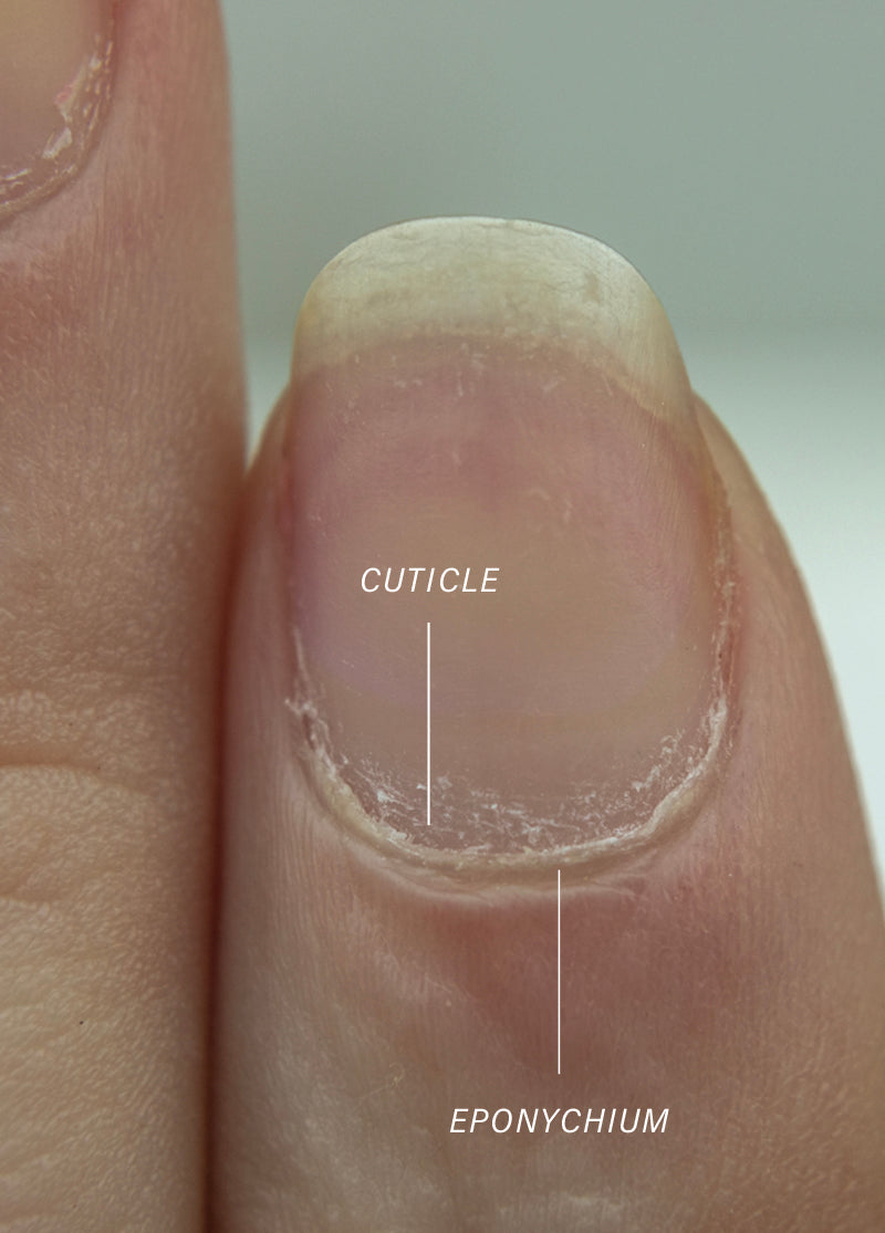 Is it normal for manicurist to make you bleed when cutting cuticle skin?  They even have liquid styptic on hand as if it's expected. - Quora