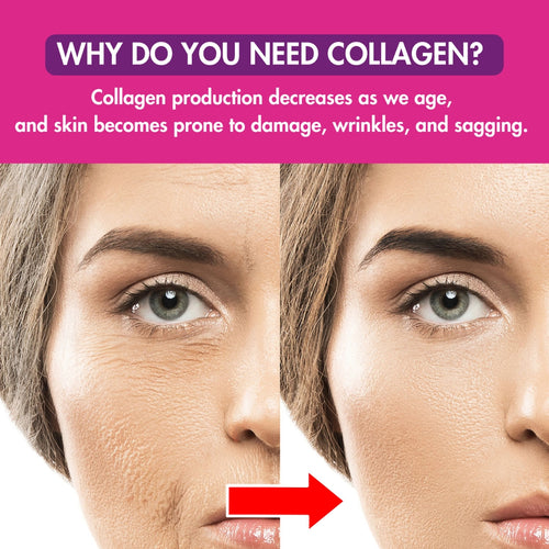 WhyDoYouNeedCollagen.jpg__PID:9ea6c97b-d003-436d-8ad8-104d8e8b819a