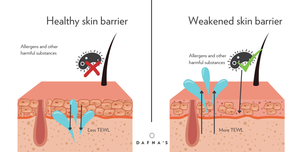 Barrier-protection-skin-ceramides-dafnaskincare