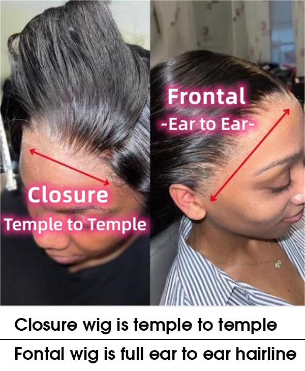hairline difference between closure wig vs frontal wig