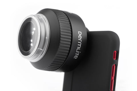 DermLite Foto dermoscopy lens for smartphones and cameras