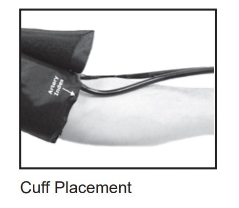Cuff Placement
