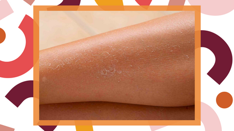dry skin leg with hanni brand background