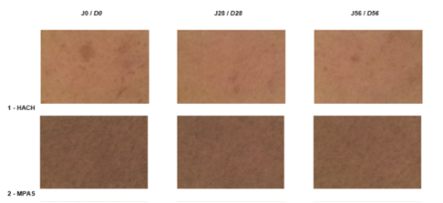 Eclaircissement du teint de la peau après 28 et 56 jours
