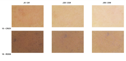 Eclaircissement du teint de la peau après 82 et 57 jours