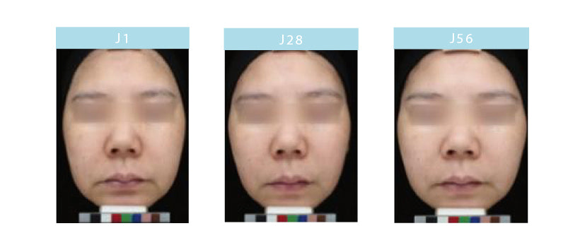 Test d’efficacité WHITE LEAF avec éclaircissement du visage après 28 jours