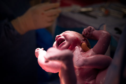 C-sections are life-saving medical interventions that have a crucial place in obstetrics.