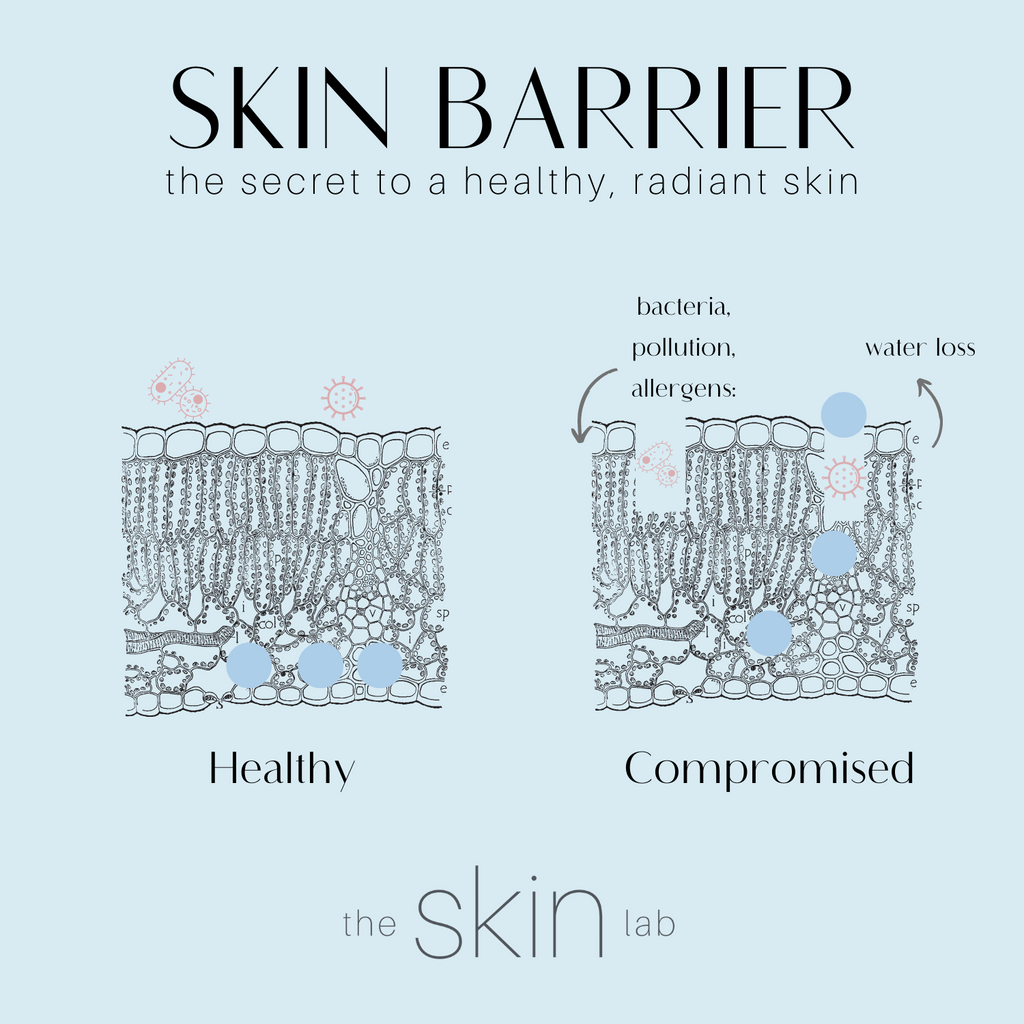 Skin barrier graphic
