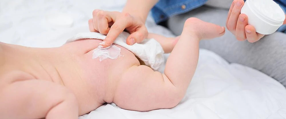 Applying diaper rash cream to baby butt