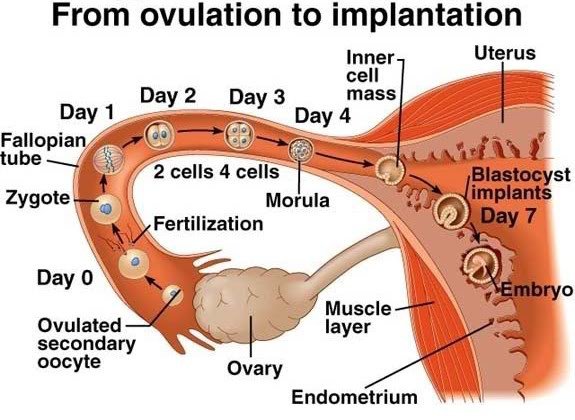 chart illustration showing implantation process