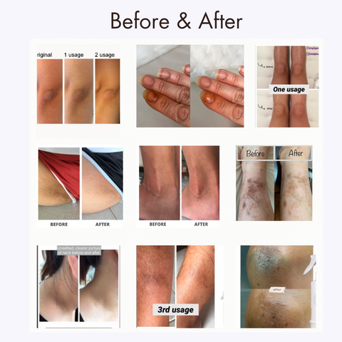 QUP Skin Sake Before & After