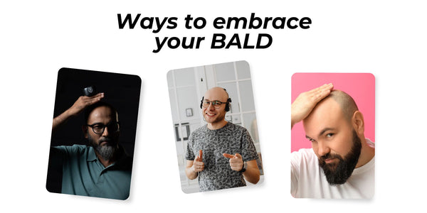 Ways to be embrace Bald!