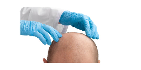 Consulting with a doctor or dermatologist who specializes in hair loss