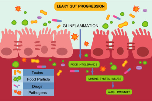 Leaky Gut and Food Intolerances
