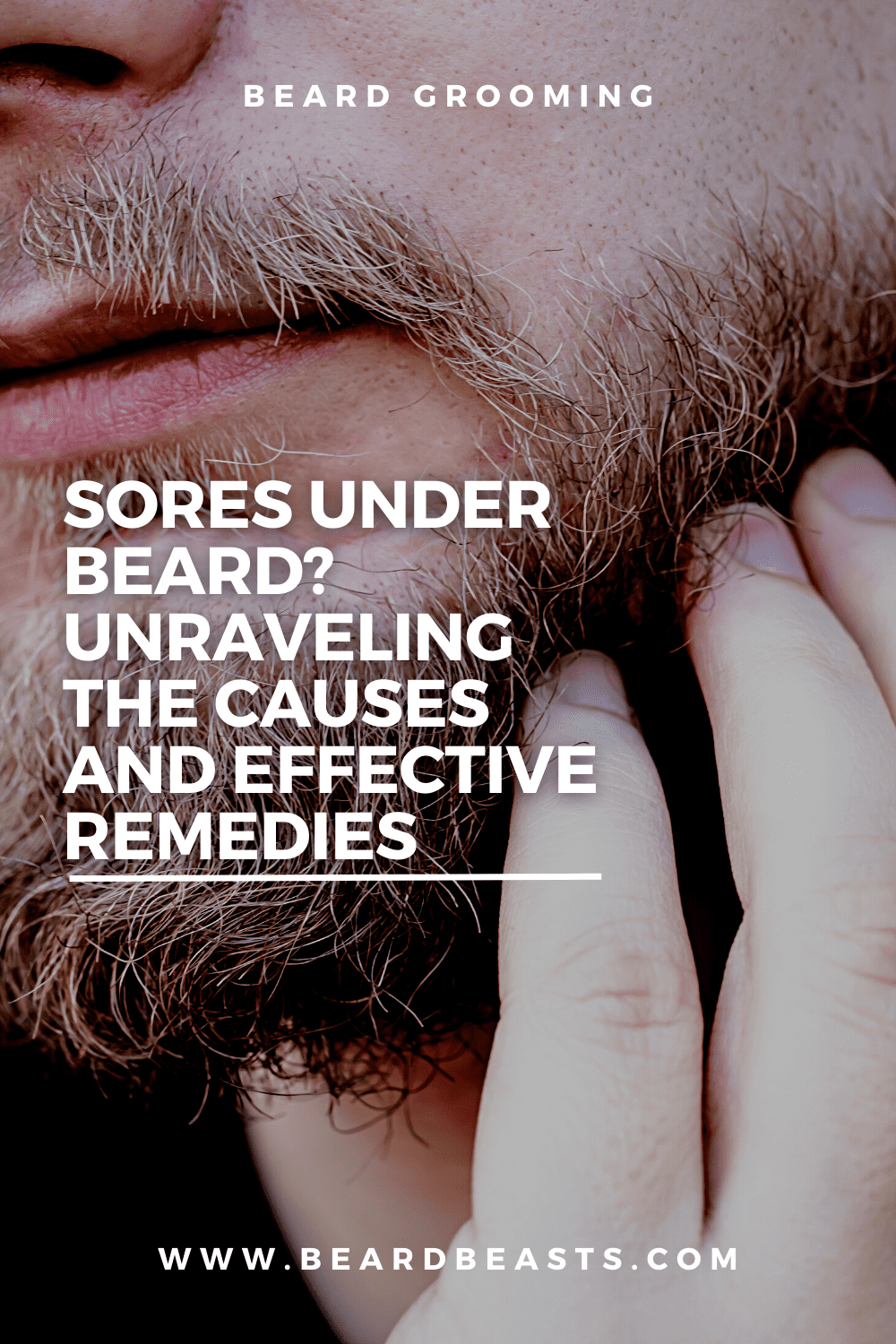 Sores Under Beard?  Unraveling  the Causes  and Effective Remedies Pinterest Pin
