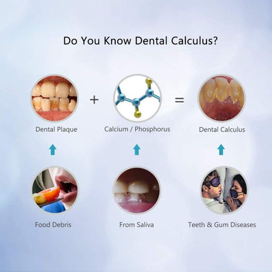 teeth calculus growth rate