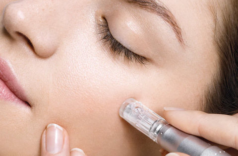 microneedling