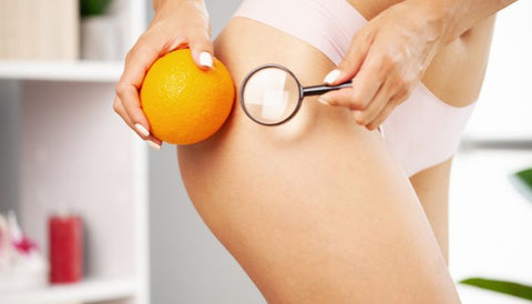 cellulite ritenzione