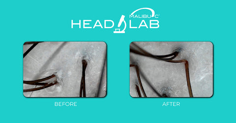 Before and after scalp images after the Malibu C Head Lab Service
