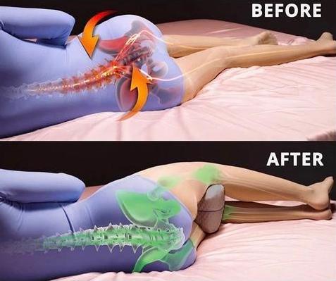 ProSleepy™ Orthopedic Knee Pillow: eliminate Knee pain when sleeping -  ProSleepy