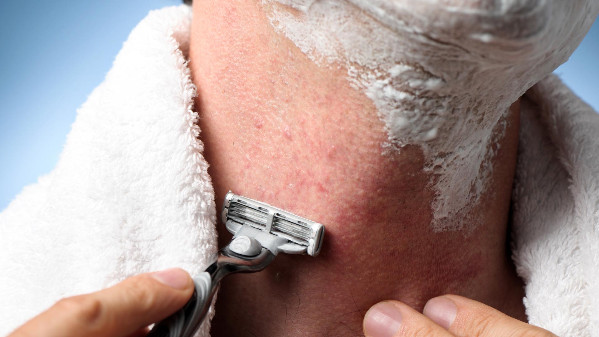 How to Prevent Ingrown Hairs From Shaving