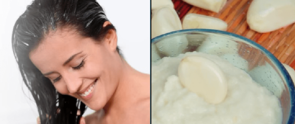 Garlic for Dandruff treatment at home