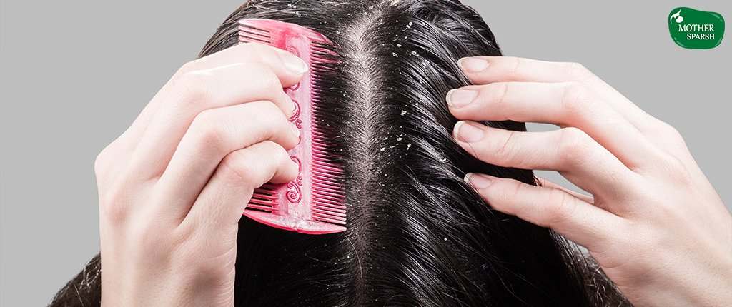 Hair Treatment for Dandruff