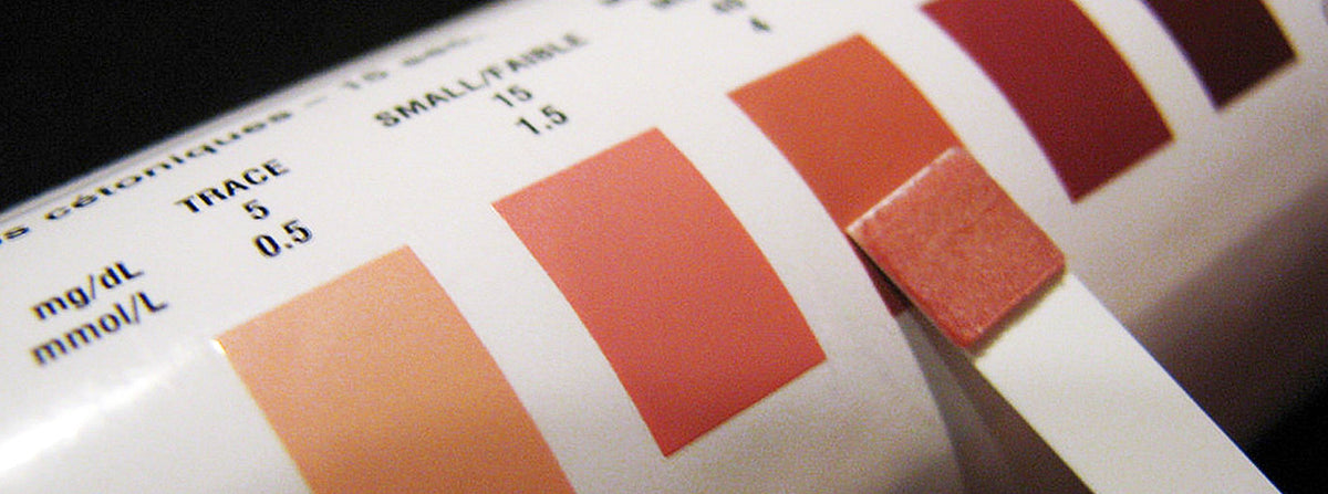 Image depicting ketones in urine