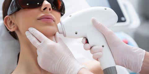 Laser Hair Removal