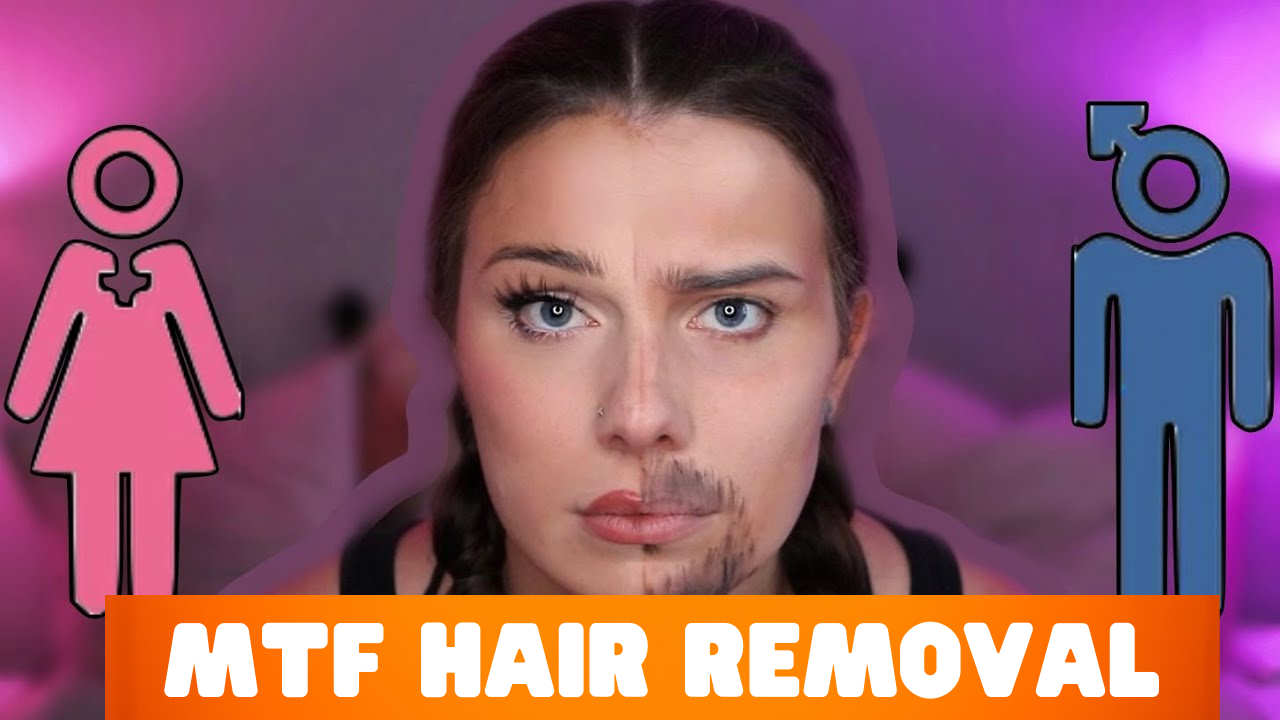 transgender laser hair removal