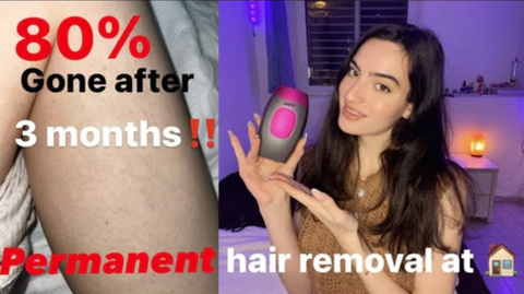 is ipl hair removal worth it