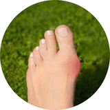 Dr Kez Chirolab Foot pain inflammation ultrasound bunion