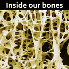 Dr Kez ChiroLab Osteoporosis Osteopenia trabelulae