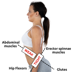 Anterior pelvic tilt tight hip flexors tight glutes gluteal muscles weak abs abdominal muscles tight erector spinnae muscles tight hip flexors iliopsoas psoas muscle