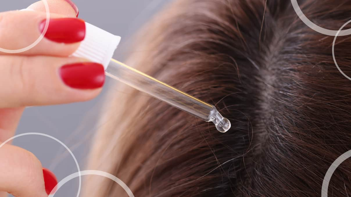 woman putting dandruff ointment on her head