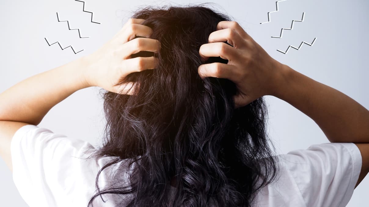 Loss of hair from stress