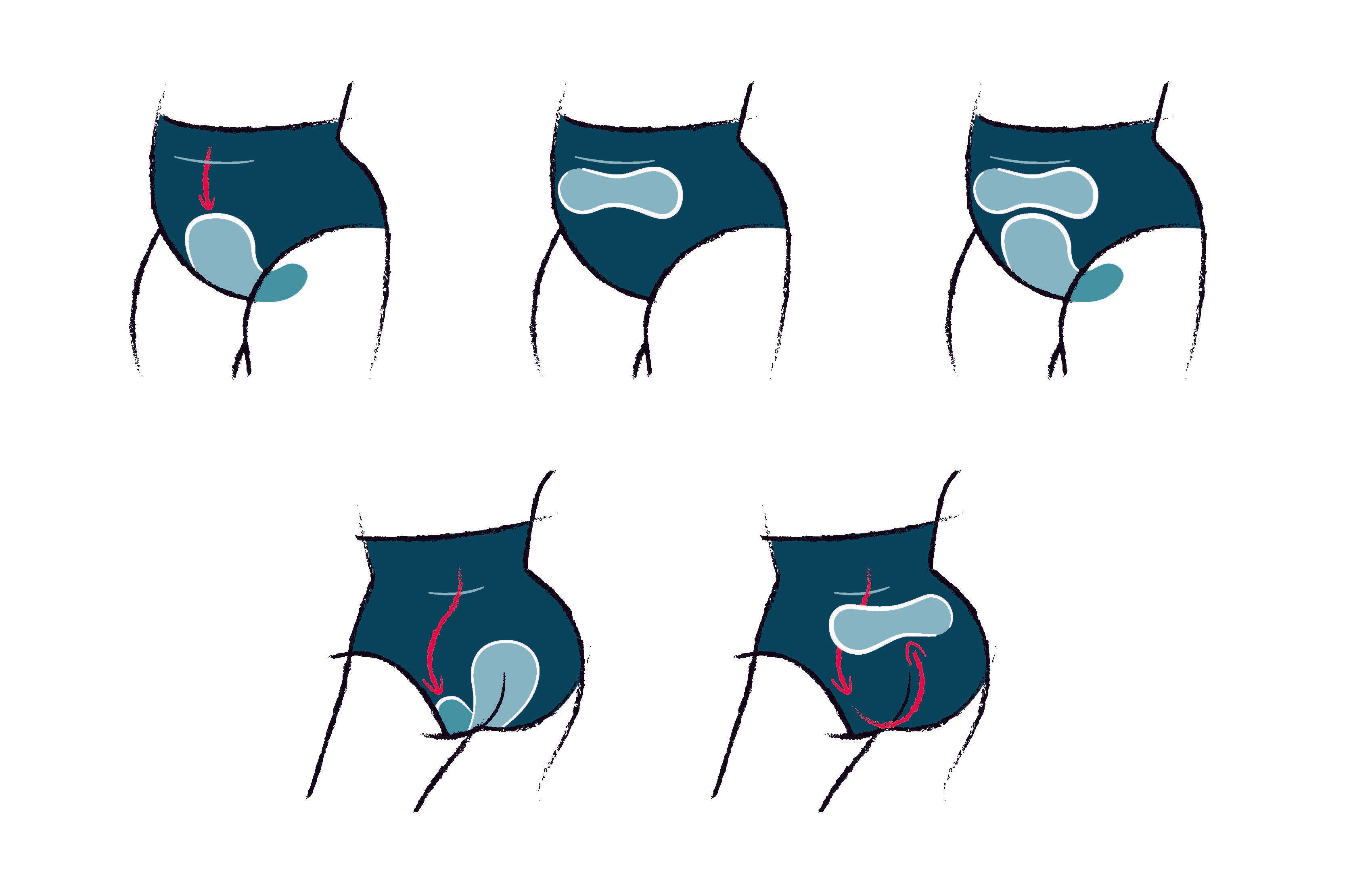 Illustrations of potential positioning of ice/heat packs within FourthWear Underwear