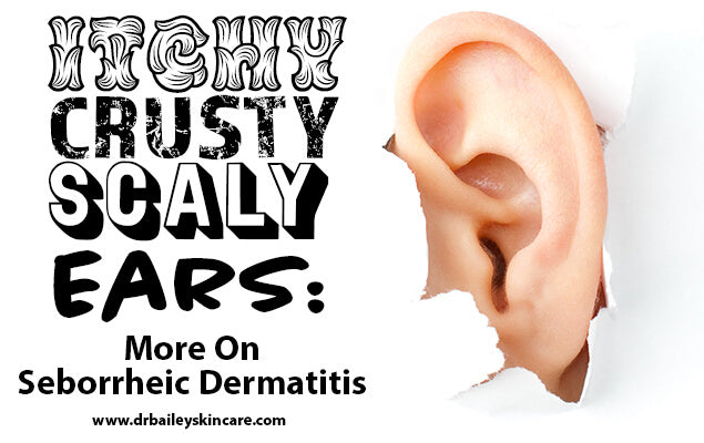 Treatment for seborrheic dermatitis on itchy, crusty, scaly ears