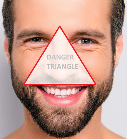 danger triangle of the face how to pop a pimple